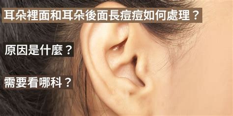 耳朵上方長痘痘|耳朵裡面和耳朵後面長痘痘如何處理？原因是什麼？需要看哪科？